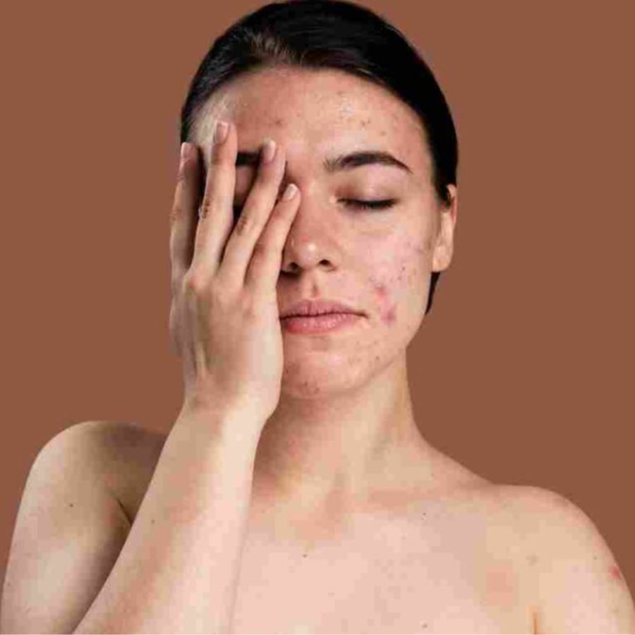 শুধু তাই নয়, চোখের মেকআপ উঠে না গেলে সংক্রমণ, জ্বালা, এমনকি ‘স্টাই’ পর্যন্ত হতে পারে।