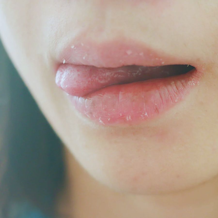 অভ্যাসের দিকেও নজর জরুরি। বার বার ঠোঁট চাটার অভ্যাস ত্যাগ করতে হবে। 