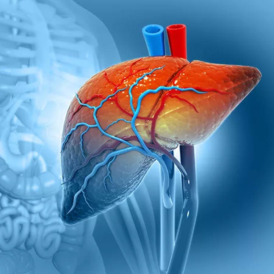 Doctor revealed most dangerous food for non-alcoholic fatty liver disease dgtl