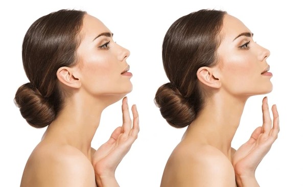 মুখের ব্যায়াম - ঠোঁট প্রসারিত করা: মাথা সোজা রাখুন। এ বার ঠোঁট দুটোকে সামনের দিকে এনে মুখ দিয়ে 'O' আকৃতি তৈরি করুন। এই অবস্থায় মুখের পেশিগুলি টানটান থাকবে। এটি ২০ সেকেন্ড ধরে রাখুন এবং দিনে ৫ বার করুন। এটি মুখের চার পাশের পেশিকে শক্তিশালী করে।