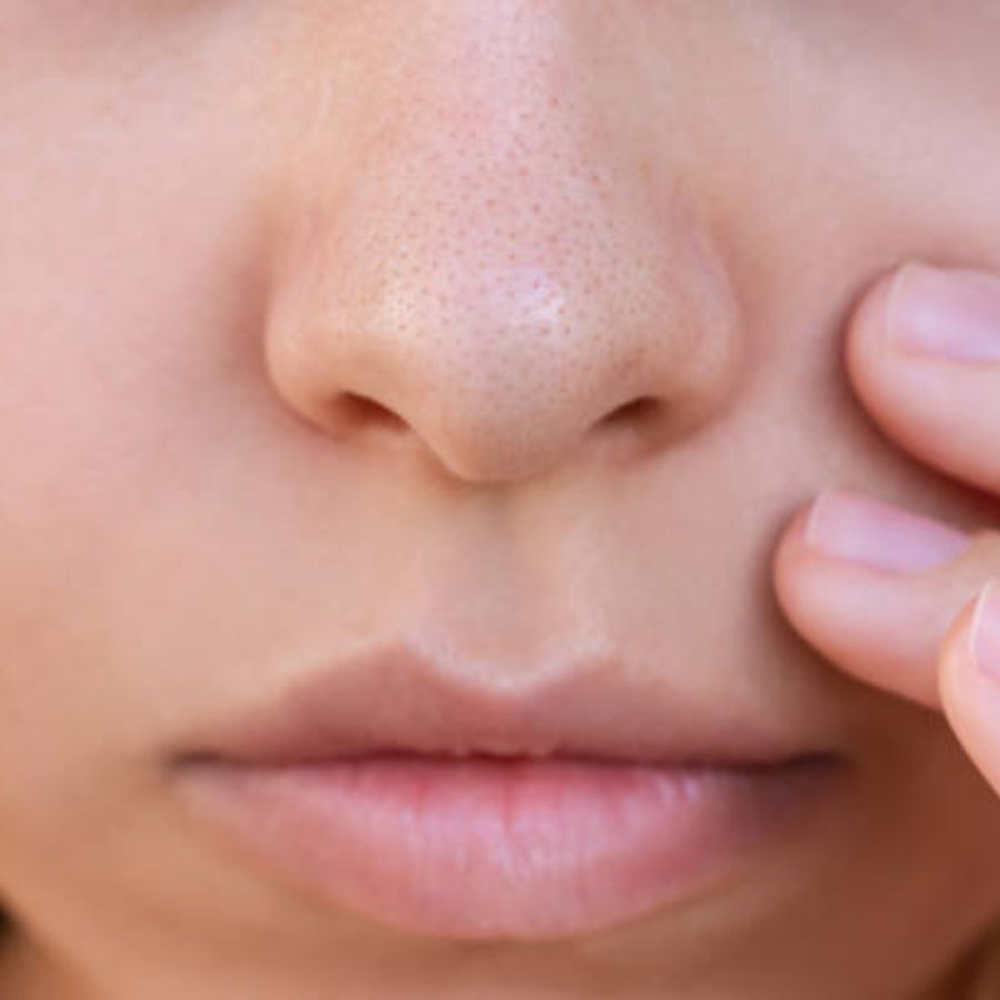 রোদে পুড়ে হওয়া দাগছোপ দূর করা হোক অথবা ব্রণ ও উন্মুক্ত রন্ধ্রের সমস্যা, ক্লে মাস্কেই মিলতে পারেন সমাধান। ত্বকের উপর ক্লে মাস্ক চুম্বকের মতো কাজ করে। ছোট ছোট রন্ধ্রের মধ্য দিয়েও সমস্ত মৃত কোষ, জমে থাকা ধুলো-ময়লা বের করে নিয়ে আসে এটি। এ ছাড়া দূর করে ব্ল্যাক হেড্‌স ও হোয়াইট হেড্‌স-এর মতো সমস্যাও। 