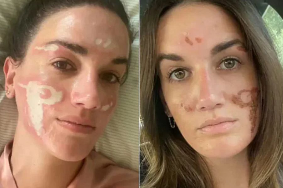 টিক টকে নিজের মুখের এই ছবি দু’টি শেয়ার করেছেন অভিযোগকারিনী ভিক্টোরিয়া নেলসন। 