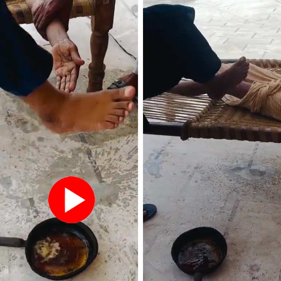 Pakistani doctor uses feet for the treatment of a paralyzed patien