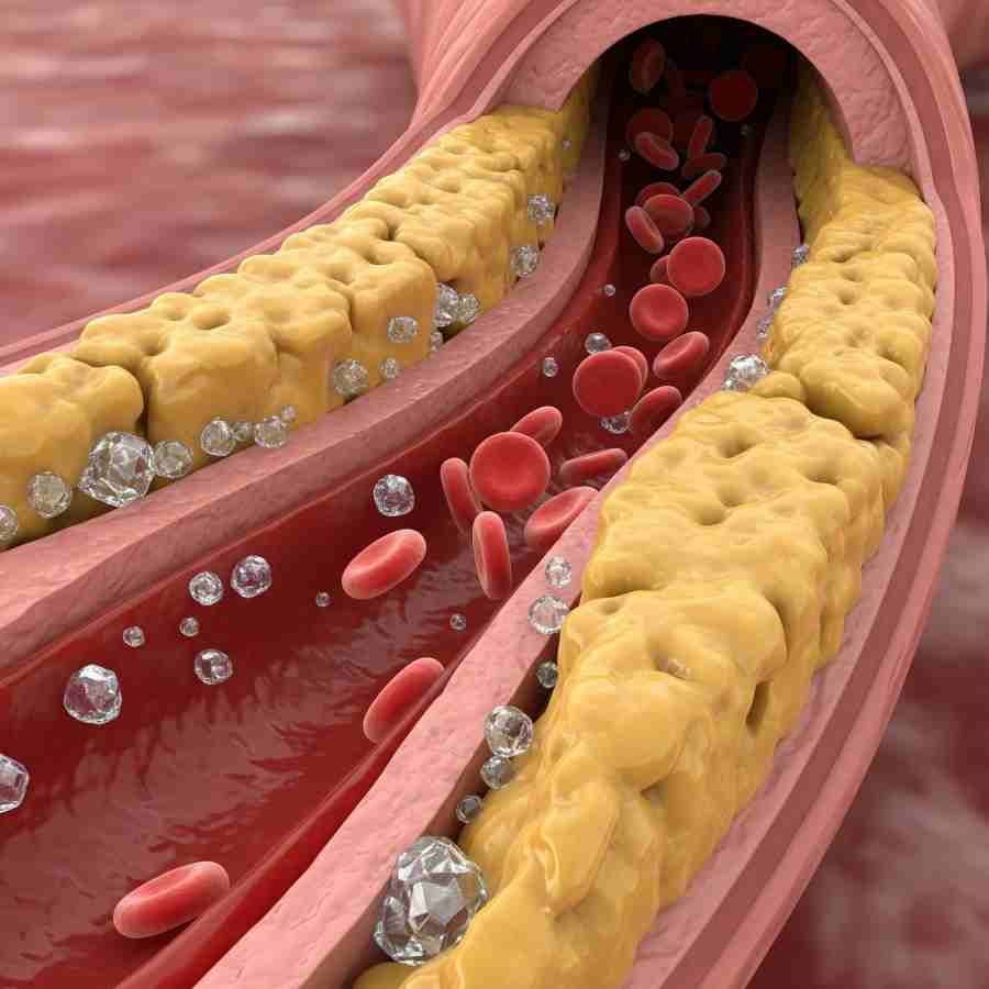 Here are some tips to reduce cholesterol within 30 days dgtl