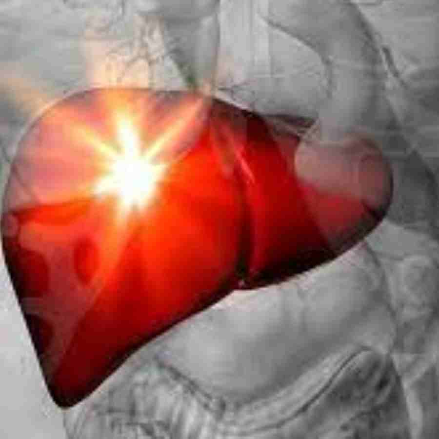 Liver failure often leads to significant sleep disturbances, what are the symptoms