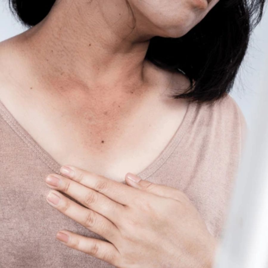 Home Remedies to Remove Dark Patches Around the Neck dgtl