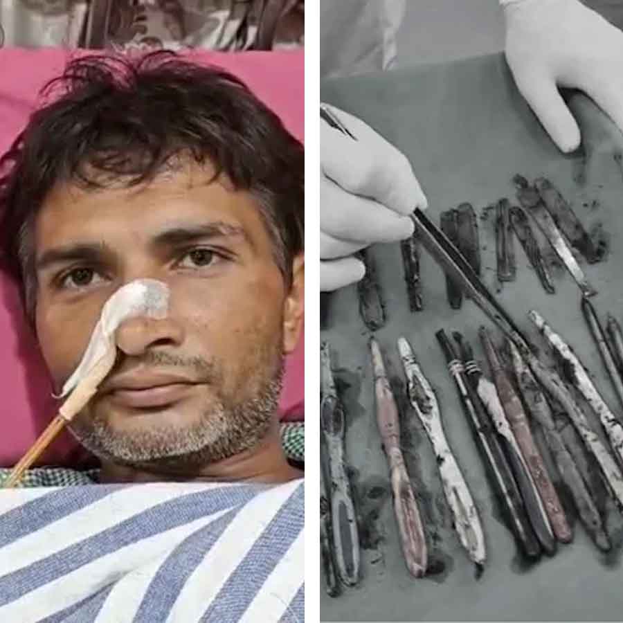 (বাঁ দিকে) মাদকাসক্ত যুবক সচিন। (ডান দিকে) তাঁর পেট থেকে উদ্ধার হওয়া ব্রাশ, চামচ। ছবি: সংগৃহীত।