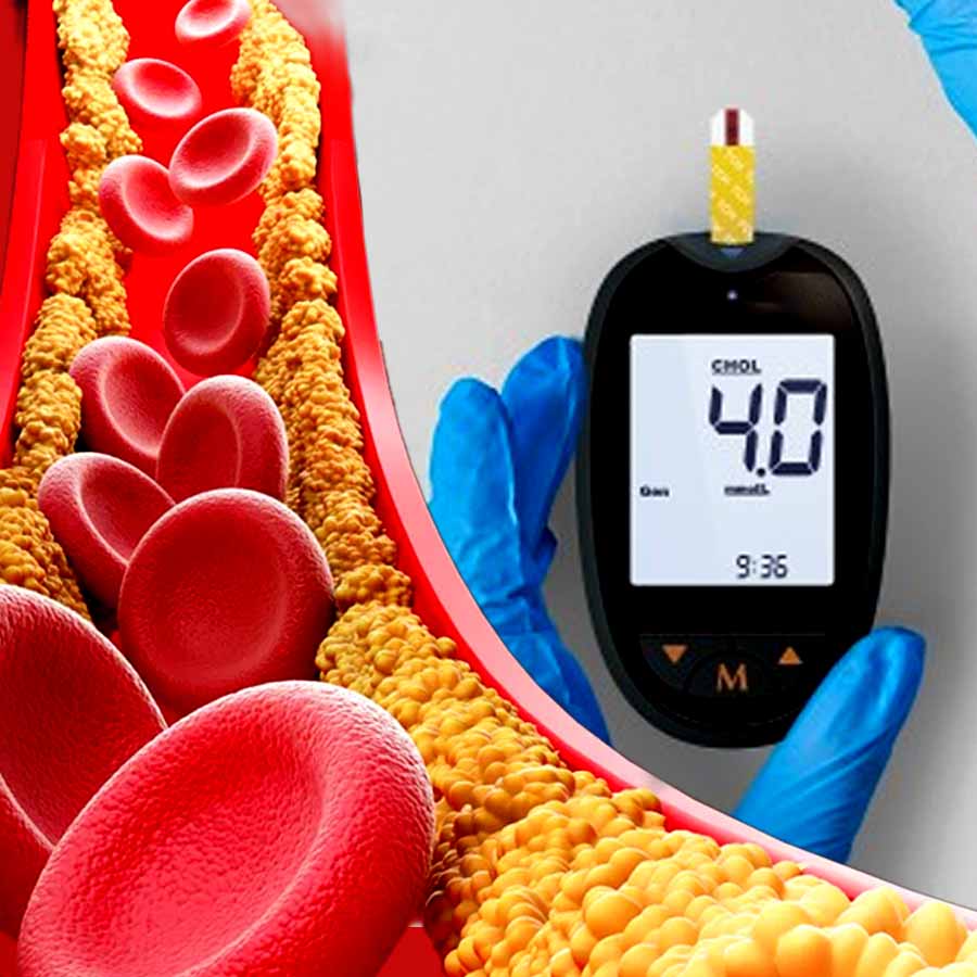 How to measure cholesterol at home