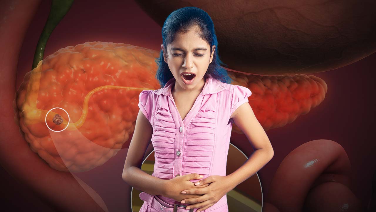 The recent diagnosis of a 10-year-old girl in Delhi NCR with chronic pancreatitis