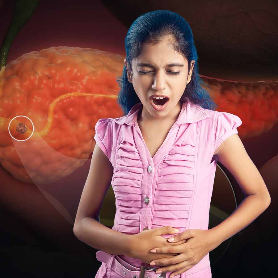 The recent diagnosis of a 10-year-old girl in Delhi NCR with chronic pancreatitis