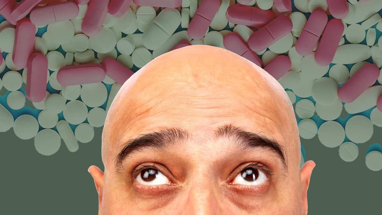 বাজারে মিলছে টাকের দাওয়াই।