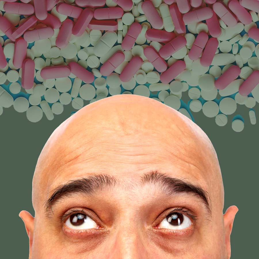 বাজারে মিলছে টাকের দাওয়াই।