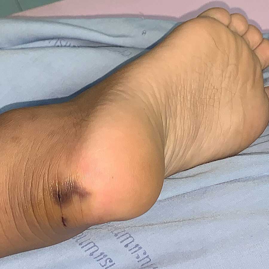 BSF Mulls Deploying Snakes, Crocodiles at Border  for Surveillance