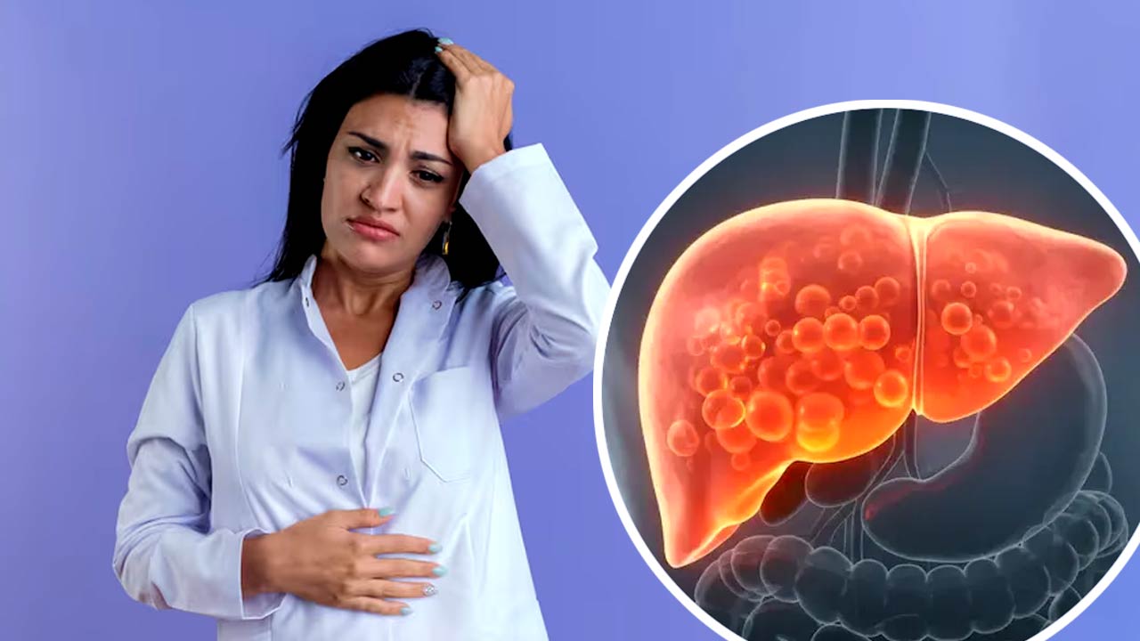 Why Declining Hormones After 45 Accelerate Liver Fat Accumulation in Women