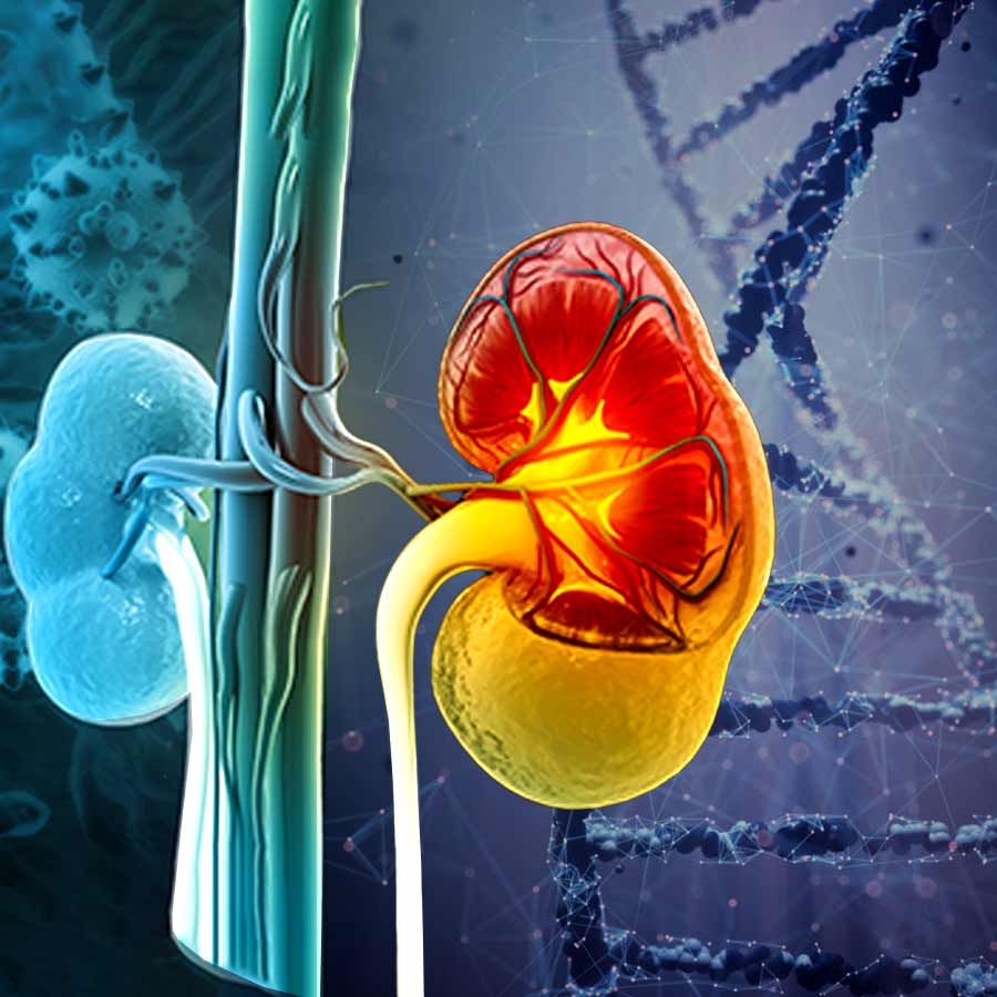 AAV Gene Therapy in Kidney Disease, a new era of Precision Medicine