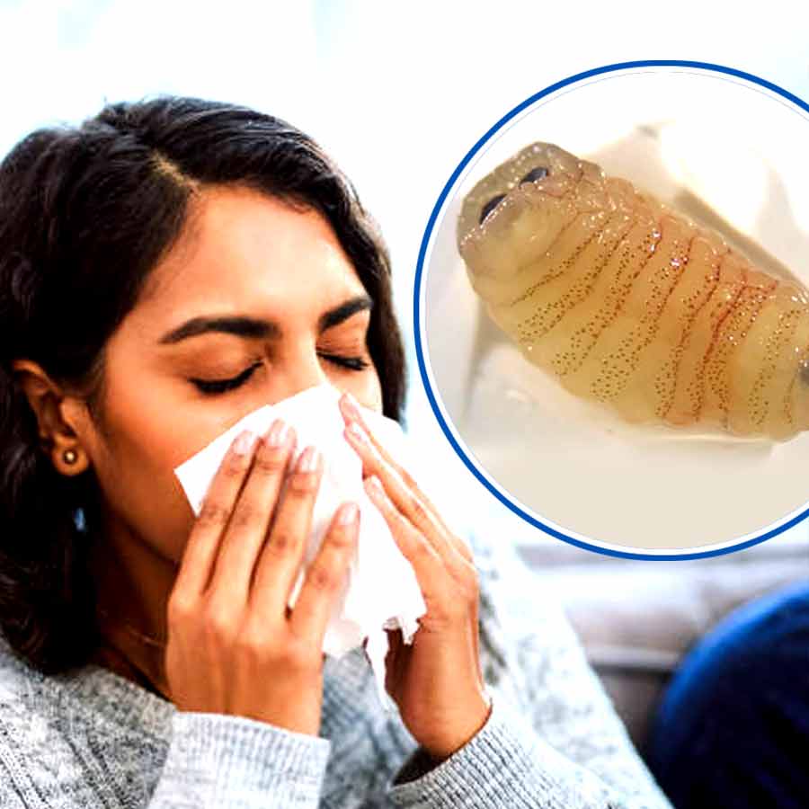 Woman sneezes out worms in rare infection doctors call biologically implausible