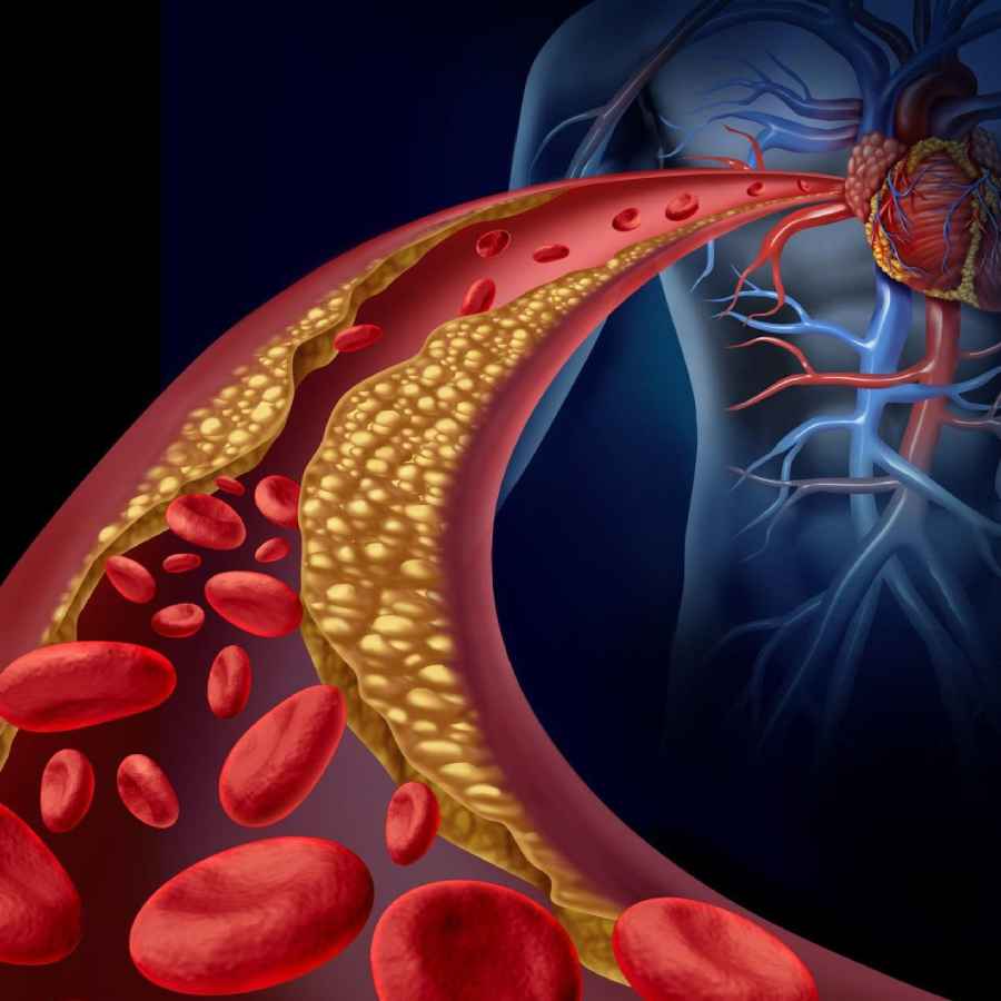 Signs of potential heart issues appearing in the legs