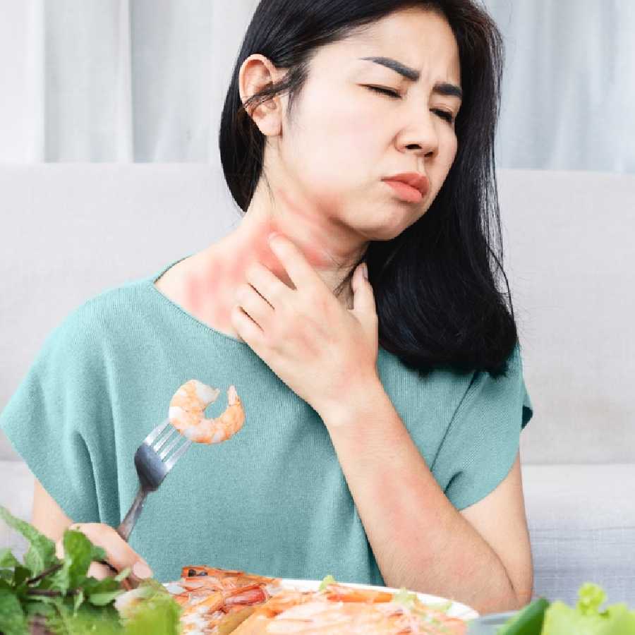 কেন বারে বারে ফিরে আসে আমবাত ?