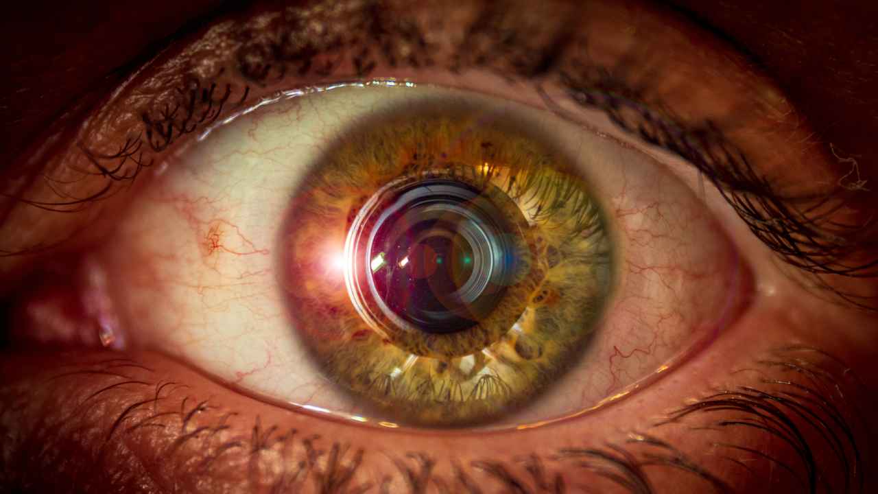 What is photokeratitis and how to prevent eye damage