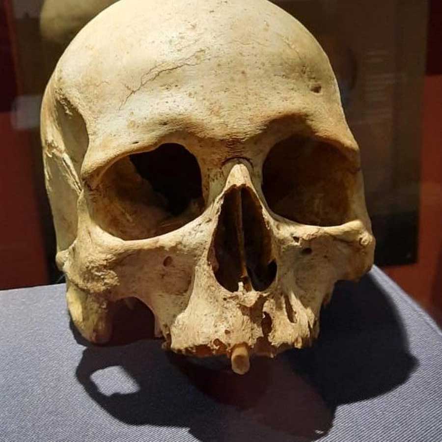 skull