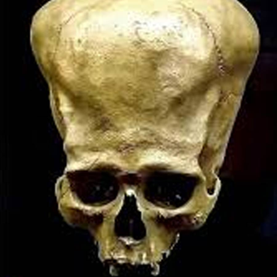 skull