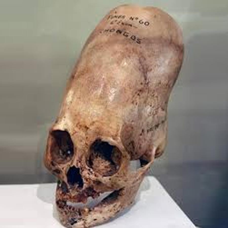 skull