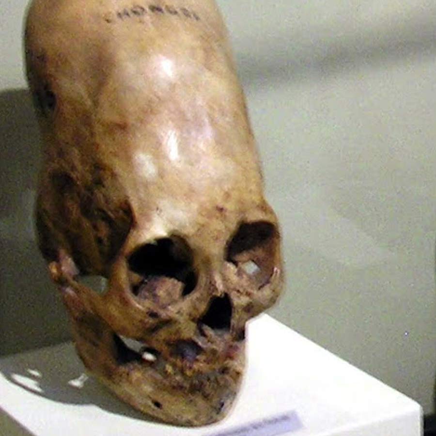 skull