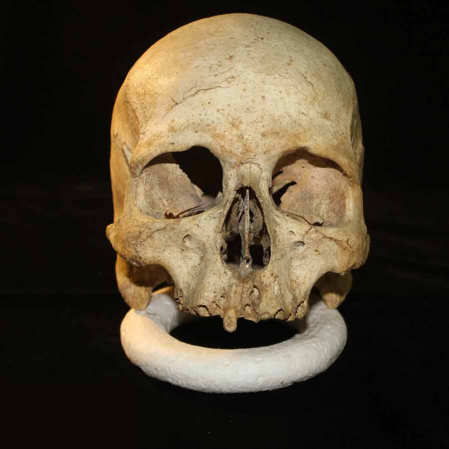 skull
