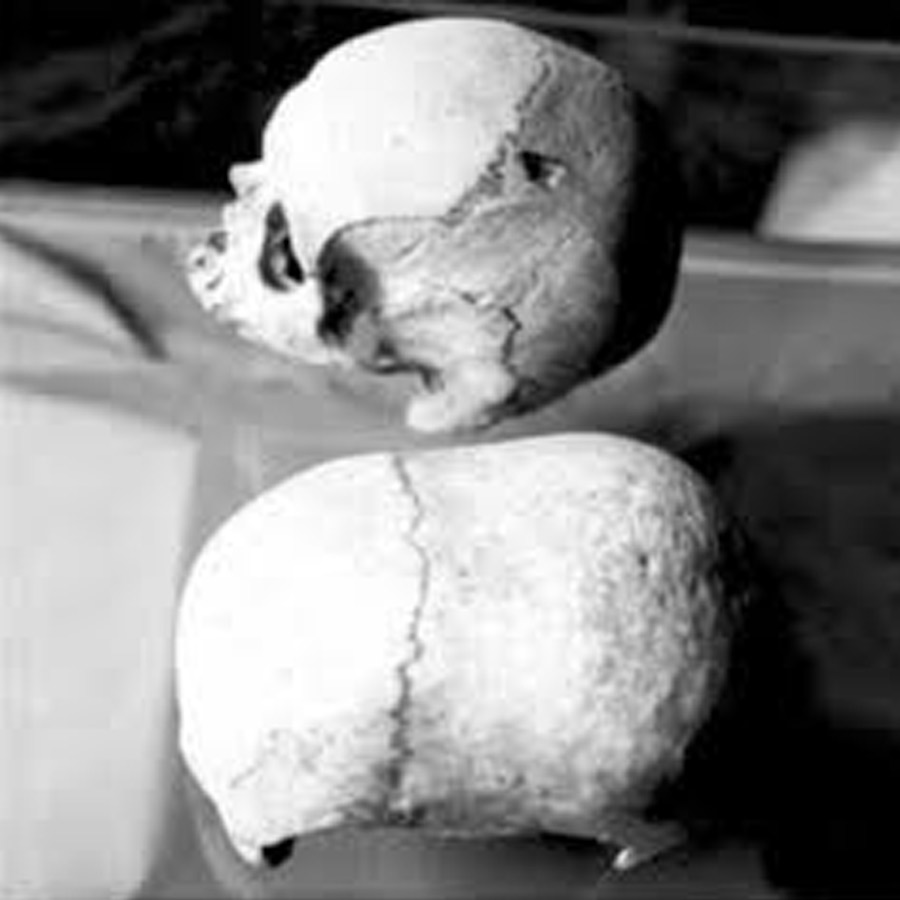 skull