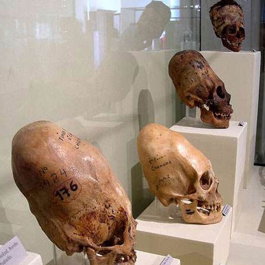 skull