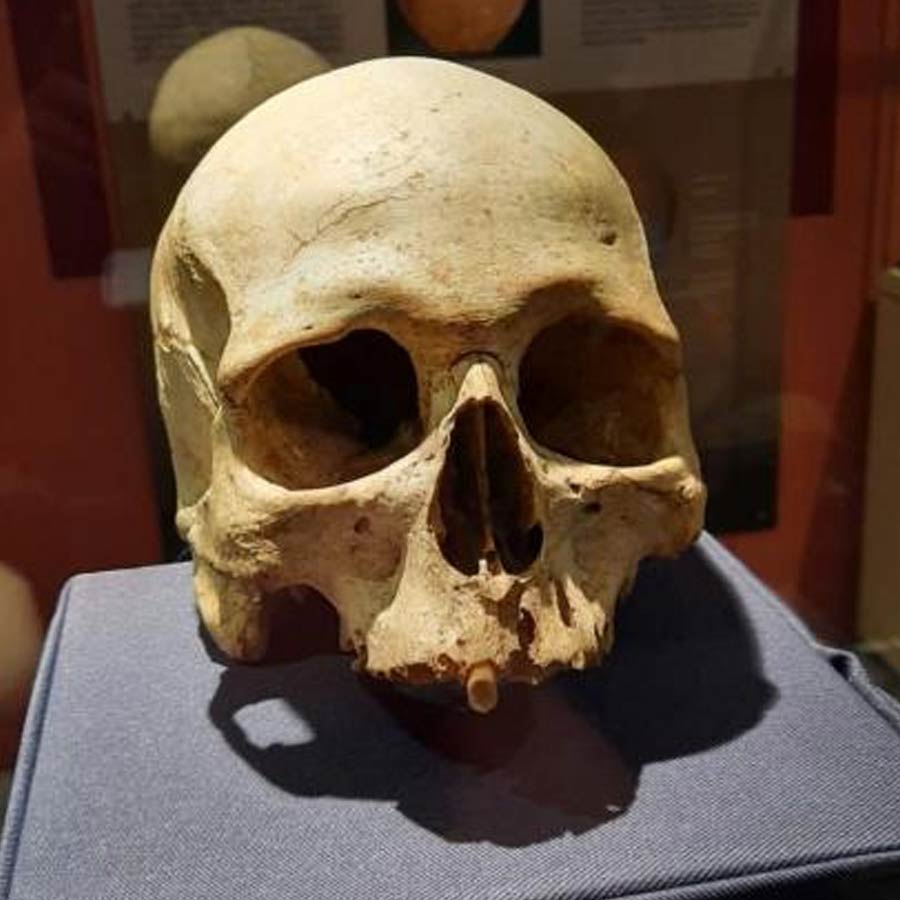 skull