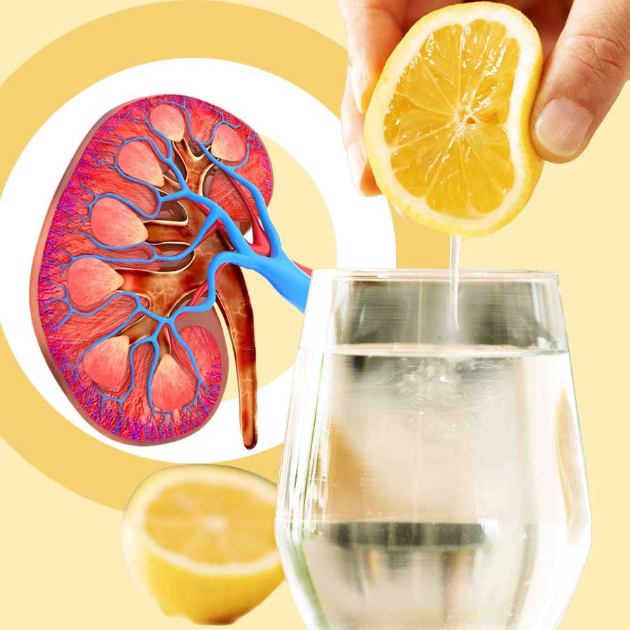 পাতিলেবুর জল কি কিডনিতে পাথার হওয়ার ঝুঁকি কমে?