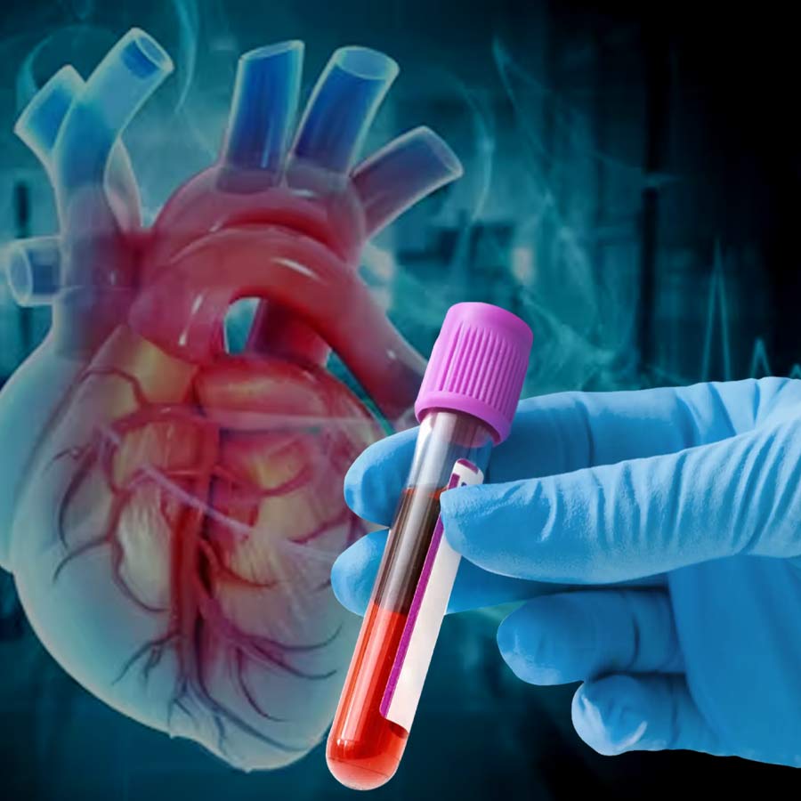 Why the apoB Blood Test is the New Gold Standard for Heart Risk