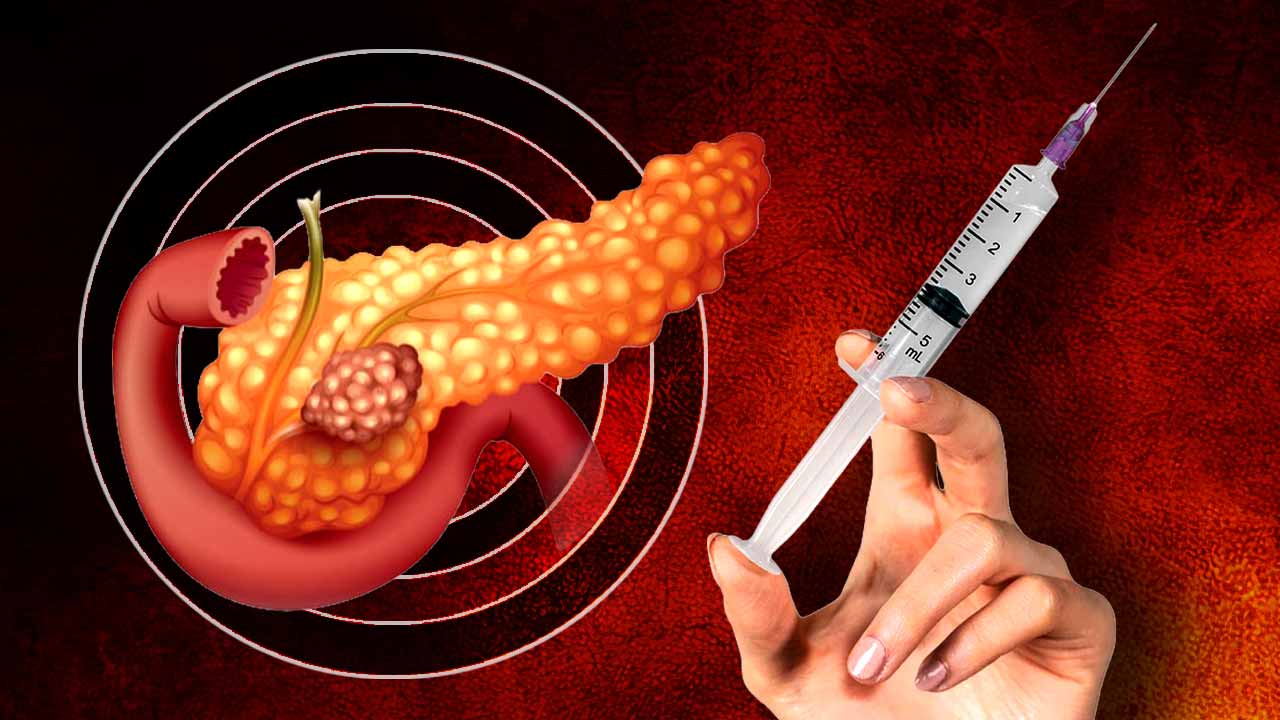 New mRNA vaccines for pancreatic cancer shows long-term survival promise