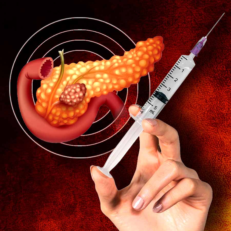 New mRNA vaccines for pancreatic cancer shows long-term survival promise