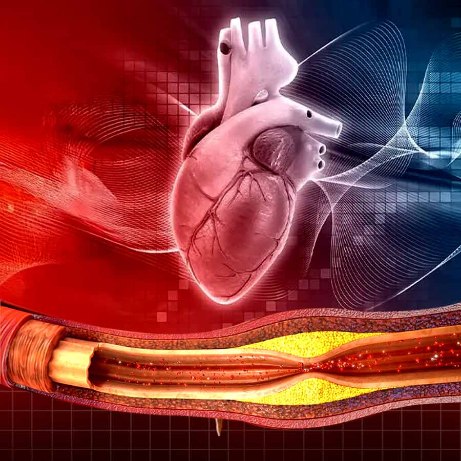 What is endothelial dysfunction, Causes & Cures of Endothelial Issues