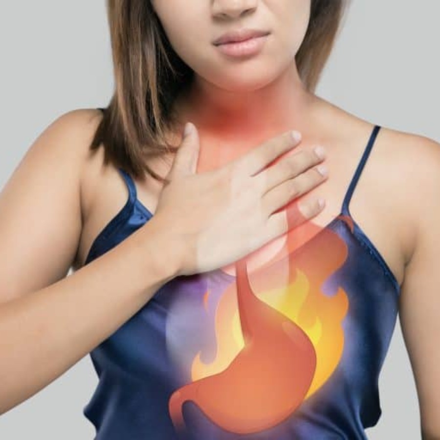 বুকজ্বালা কমাতে কী কী খাবেন?