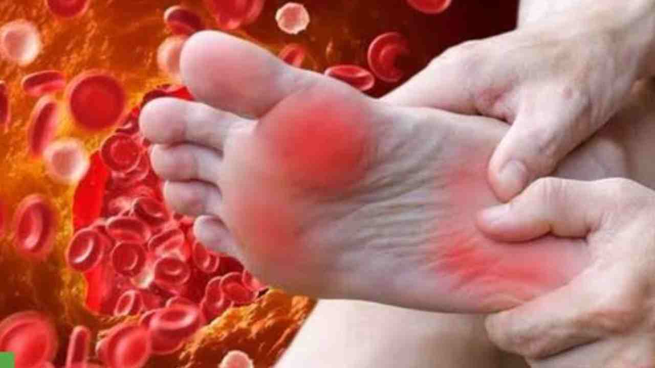 পায়ের লক্ষণে চিনে নিন কোলেস্টেরল বাড়ছে কি না