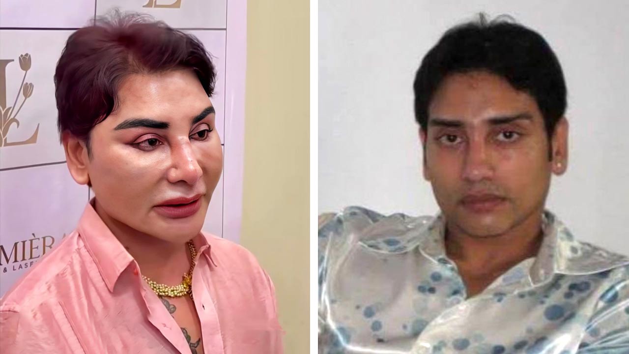 (বাঁ দিকে বর্তমান ছবি) এস্থেটিক স্পেশ্যালিস্ট সার্জন নৃপেন্দ্র গুহ (আগের ছবি ডান দিকে)।