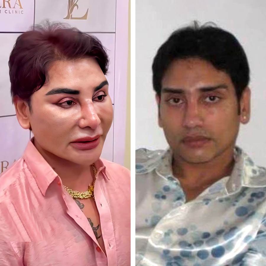 (বাঁ দিকে বর্তমান ছবি) এস্থেটিক স্পেশ্যালিস্ট সার্জন নৃপেন্দ্র গুহ (আগের ছবি ডান দিকে)।