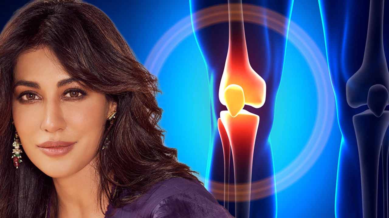 Chitrangda Singh talks about recovery of ACl surgery