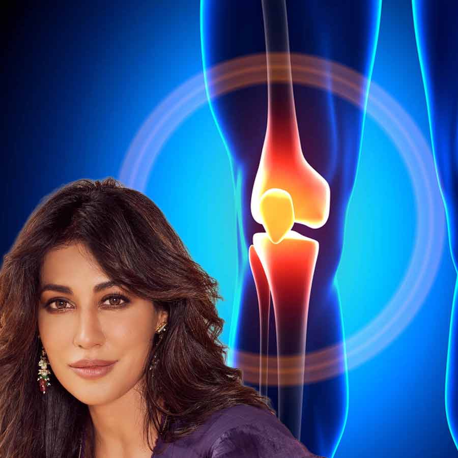 Chitrangda Singh talks about recovery of ACl surgery