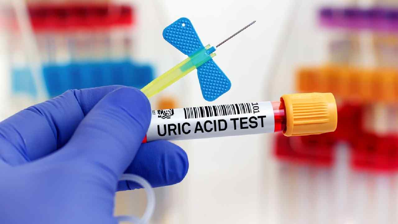 ইউরিক অ্যাসিড কমাতে কী কী করবেন?