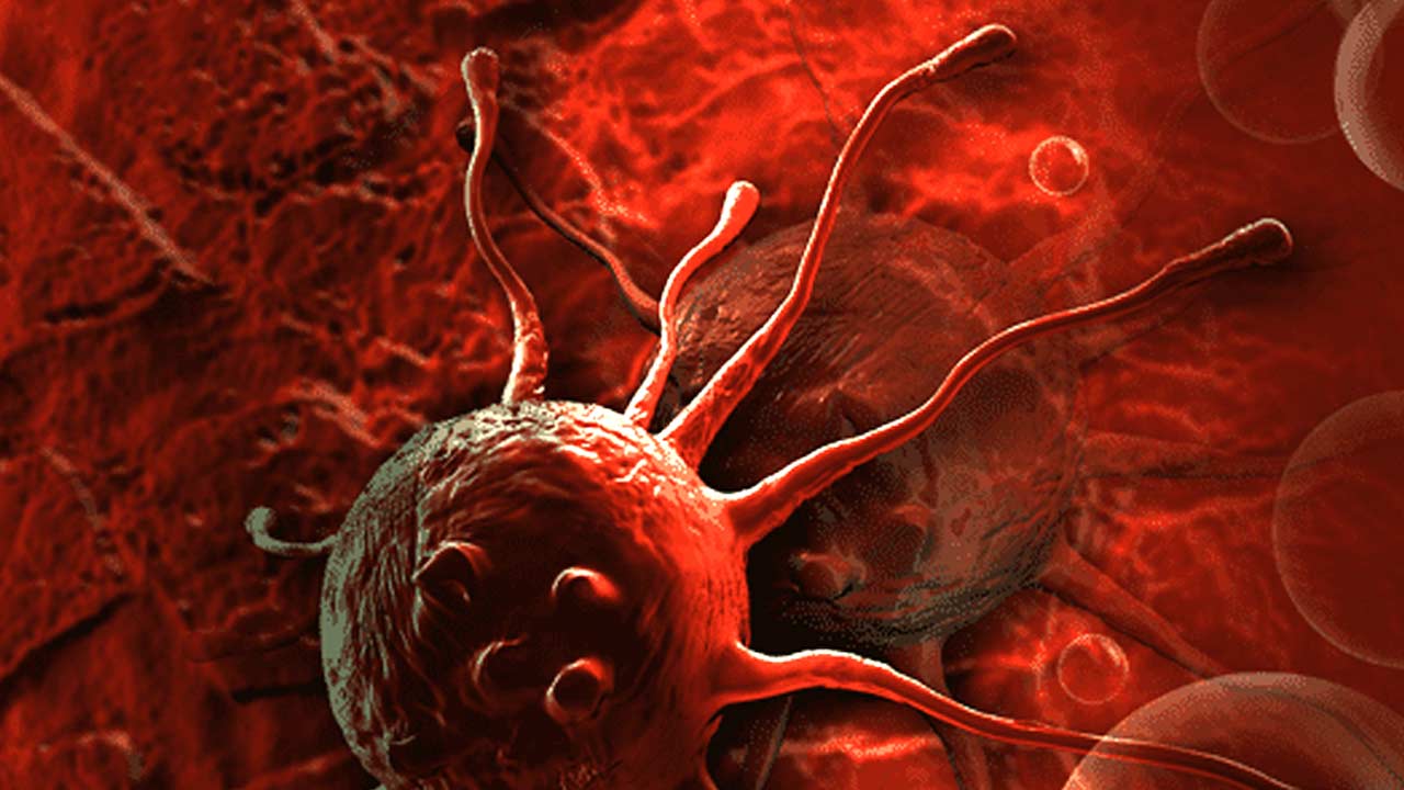 ক্যানসারের প্রাথমিক লক্ষণগুলি বুঝতে না পারলেই বিপদ। কখন সতর্ক হবেন?