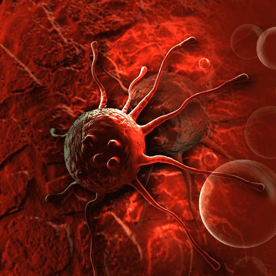 ক্যানসারের প্রাথমিক লক্ষণগুলি বুঝতে না পারলেই বিপদ। কখন সতর্ক হবেন?