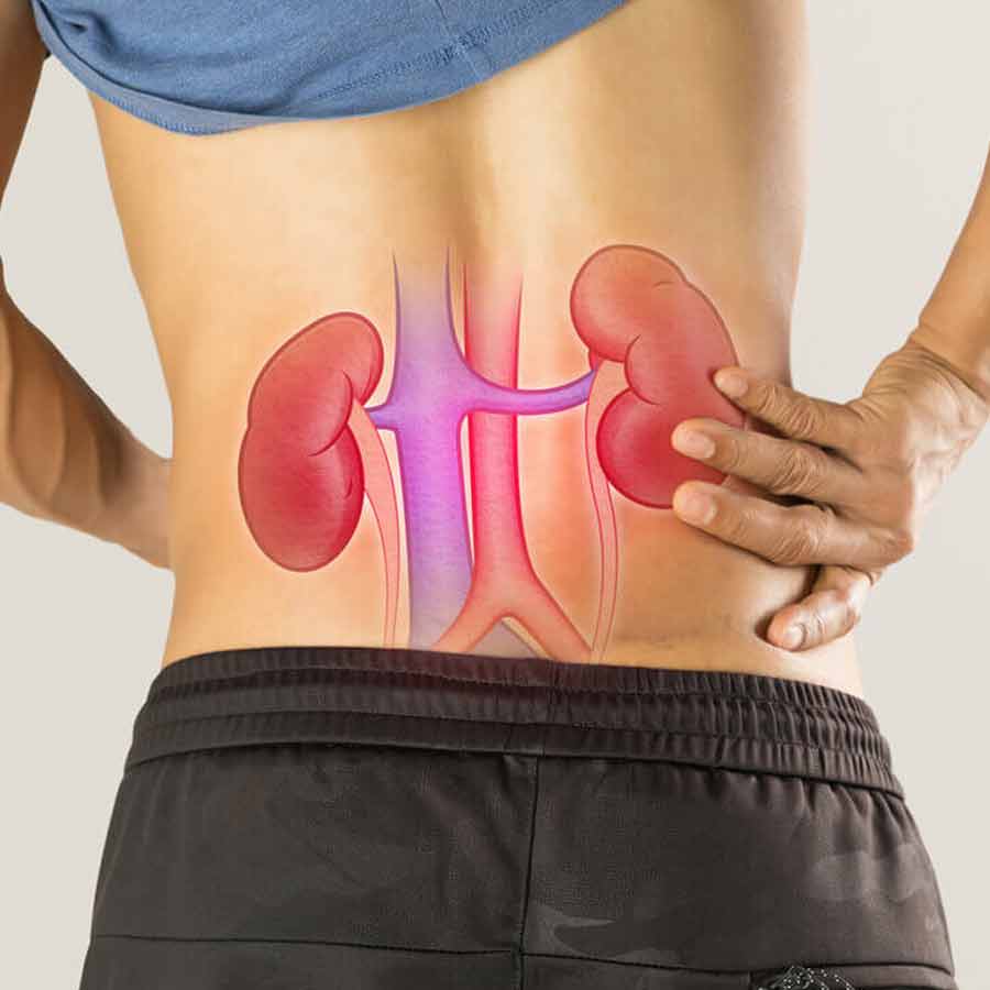 What is Fatty kidney disease, what are the symptoms and prevention tips
