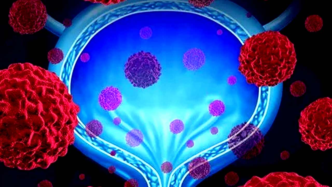 সুস্থতার সঙ্কেত মিলবে প্রস্রাবের ধরনে?