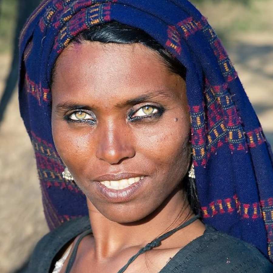All need to know about Pappu Devi, Pushkar’s woman whose eye has resemblance with tiger