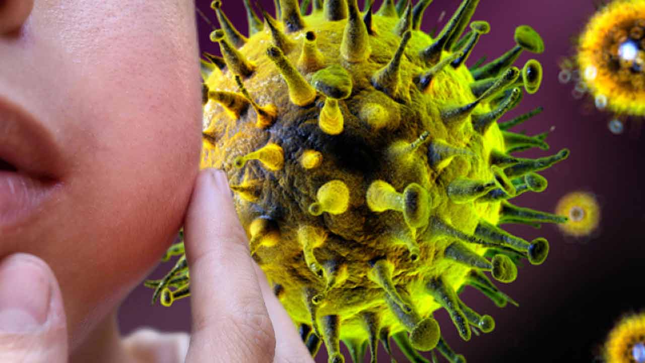 Why Mumps Rises in Spring, what are the symptoms and prevention tips