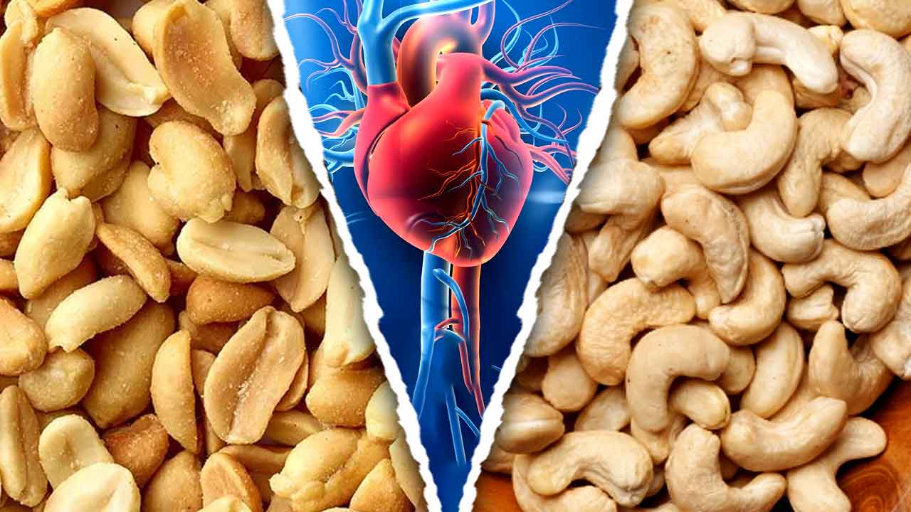 কাজুবাদাম কি কোলেস্টেরল বাড়িয়ে দেয়?